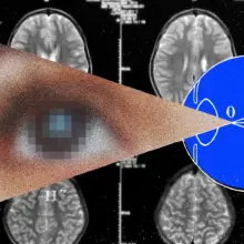 The Next Frontier for Brain Implants Is Artificial Vision image